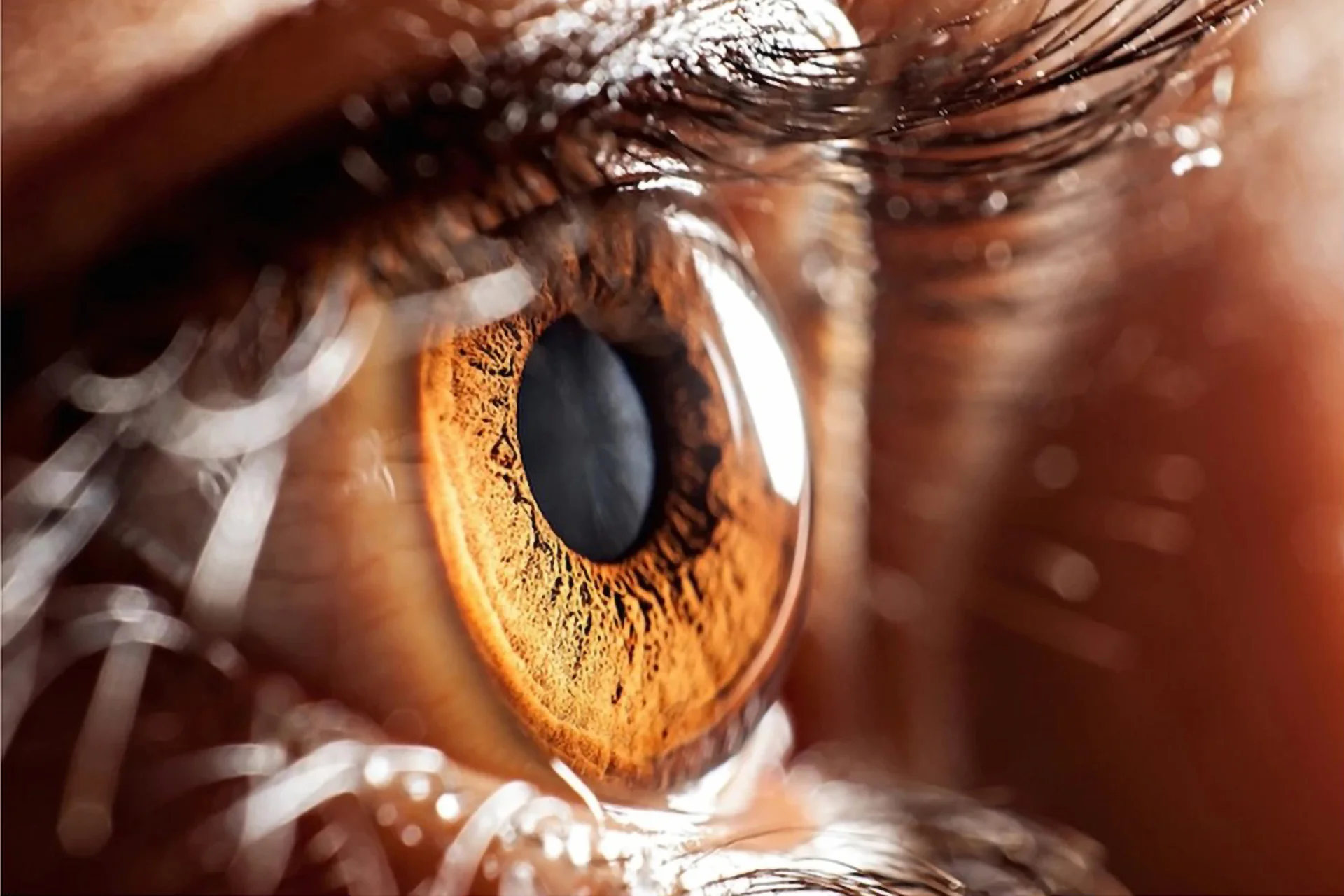 Close up of eye with dilated pupil