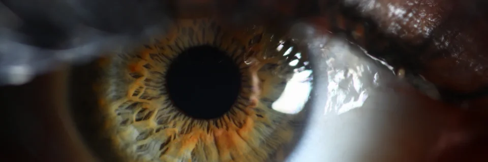 Zoomed in eye